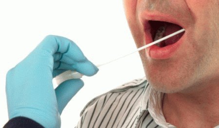 Дисбактериоз полости рта симптомы лечение у взрослых — Лечение зубов