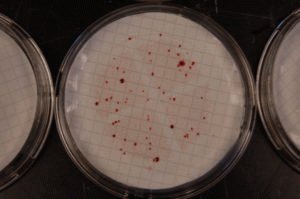Бактериологический анализ кала