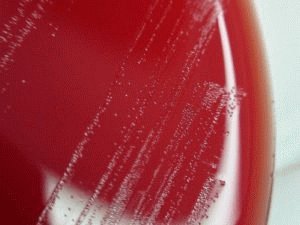 Выращивание микроба в пробирке