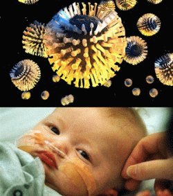 Ротавирус у младенца
