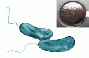 Бактерии Vibrio cholerae и V. Eltor