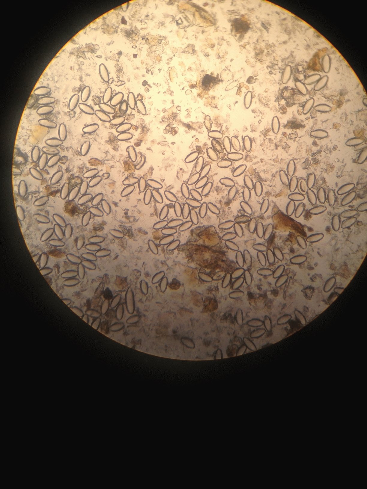 Бактерии в копрограмме. Яйца остриц микроскопия. Яйца глистов под микроскопом в Кале. Яйца остриц под микроскопом в Кале. Яйца гельминтов микроскопия.