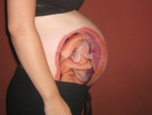 Матка беременной женщины