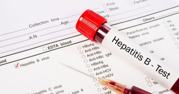 Анализ крови к вирусу гепатита