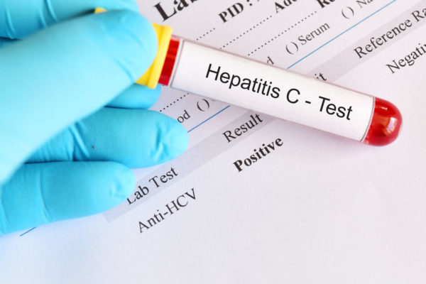 Анализ крови на гепатит С
